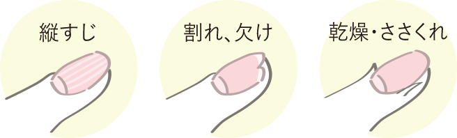 年齢を重ねるほどネイルケアが必要なのはなぜ?